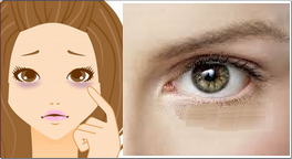 Under Eye Dark Circle Serum