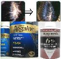 育毛（発毛）剤--ロゲイン（Rogaine）　　